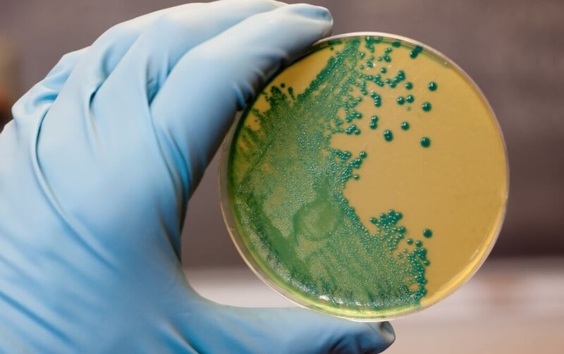 La listeria, una bacteria que provoca mucha incertidumbre