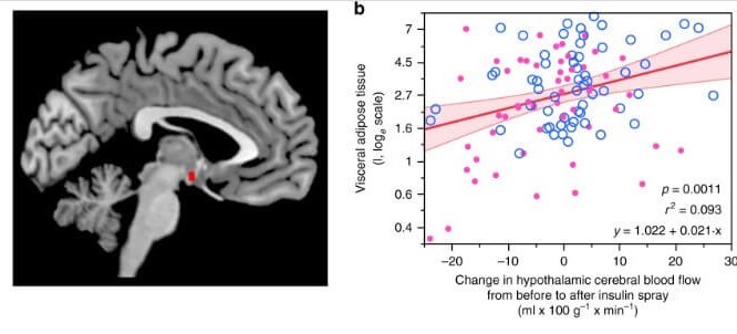 Sensibilidad a la insulina cerebral determinaría peso y distribución grasa