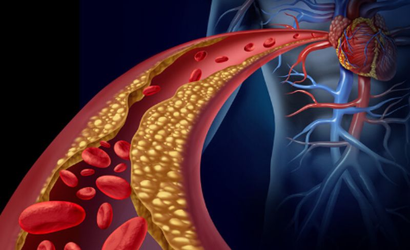 Las personas con colesterol alto deben evitar los carbohidratos y no las grasas saturadas, revela un estudio