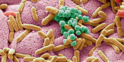 Últimas evidencias de intervenciones clínicas dirigidas al microbiota intestinal en enfermedades cardiometabólicas.