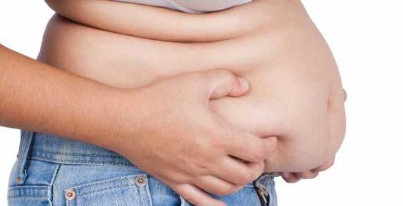 La paradoja de la obesidad es falsa: el exceso de peso aumenta el riesgo de muerte